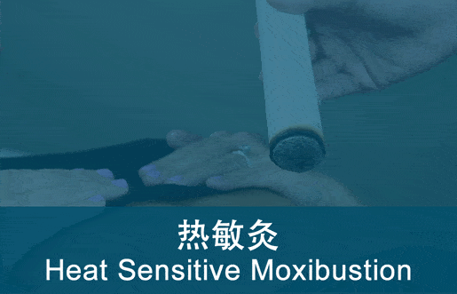 Heat Sensitive Moxibustion